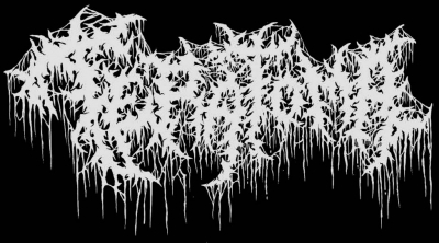 Teratoma